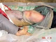 '遗体令人惨不忍睹，后背被电棍电的紫黑、溃烂，腰部、臀部伤痕累累。'
